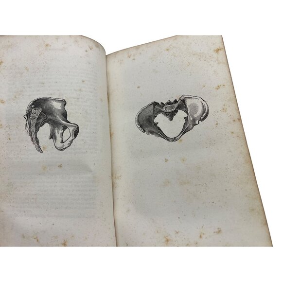 1838 The Philadelphia Practice of Midwifery Charles D Meigs First Ed Illustrated - Picture 6 of 12